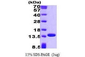 Figure annotation denotes ug of protein loaded and % gel used. (PFN1 Protein (AA 1-140))