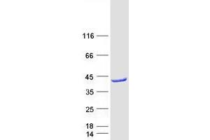 Acad8 Protein (Myc-DYKDDDDK Tag)