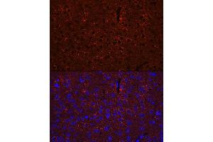 Immunofluorescence analysis of mouse brain using G Rabbit pAb (ABIN3021187, ABIN3021188, ABIN3021189 and ABIN6214056) at dilution of 1:100 (40x lens). (GAD65 antibody  (AA 401-585))