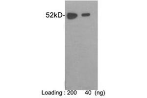 Western blot analysis of E-tag fusion protein using 1 µg/mL Rabbit Anti-E-tag Polyclonal Antibody (ABIN398457) The signal was developed with One-Step WesternTM Complete Kit (Rabbit) (ABIN491509) (E Tag antibody)