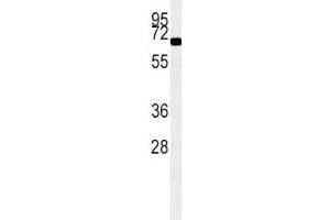 ACOX1 antibody