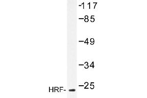 Image no. 1 for anti-Tumor Protein, Translationally-Controlled 1 (TPT1) antibody (ABIN272165)
