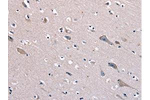 The image on the left is immunohistochemistry of paraffin-embedded Human brain tissue using ABIN7129969(KCNQ5 Antibody) at dilution 1/60, on the right is treated with fusion protein. (KCNQ5 antibody)