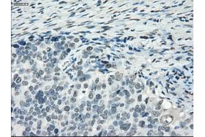 Immunohistochemical staining of paraffin-embedded colon tissue using anti-PDE10A mouse monoclonal antibody. (PDE10A antibody)