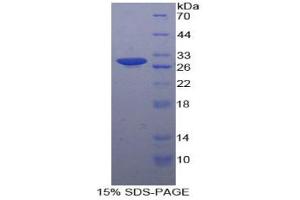 SDS-PAGE analysis of Human MAP4K5 Protein.