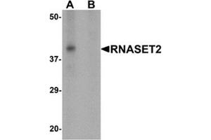 Western blot analysis of RNASET2 in SW480 cell lysate with RNASET2 Antibody  at 1 ug/mL in (A) the absence and (B) the presence of blocking peptide.