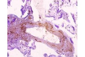 Immunohistochemistry of paraffin-embedded human placenta tissue using ABIN7170369 at dilution of 1:10 (Sorting Nexin 2 antibody  (AA 1-102))