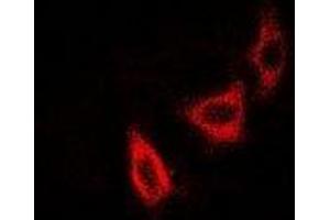 Immunofluorescent analysis of NUDE staining in SKOV3 cells. (NudE Neurodevelopment Protein 1 (NDE1) antibody)