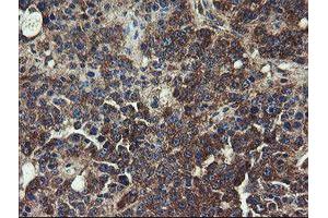 Image no. 11 for anti-Ubiquitin-Conjugating Enzyme E2, J1, U (UBE2J1) antibody (ABIN1501637)