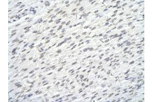 Rabbit Anti-SUPT6H antibody        Paraffin Embedded Tissue:  Human Heart cell   Cellular Data:  Epithelial cells of renal tubule  Antibody Concentration:   4. (Spt6 antibody  (N-Term))