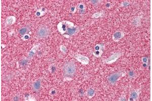 Human Brain, Cortex: Formalin-Fixed, Paraffin-Embedded (FFPE) (Septin 3 antibody  (AA 15-26))