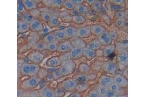 IHC-P analysis of Mouse Tissue, with DAB staining. (PIGR antibody  (AA 352-457))