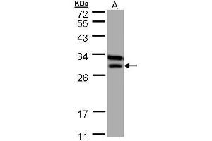WB Image Sample (30 ug of whole cell lysate) A: MOLT4 , 12% SDS PAGE antibody diluted at 1:1000 (ETFB antibody)