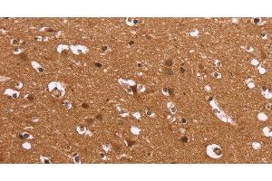 Immunohistochemistry of paraffin-embedded Human brain using HDLBP Polyclonal Antibody at dilution of 1:50 (HDLBP antibody)