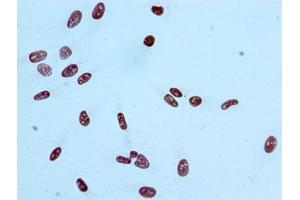 Immunocytochemistry analysis of ABIN7127265 diluted at 1:100 and staining in Hela cells performed on a Leica BondTM system. (Recombinant HIST1H2AB antibody  (acLys9))