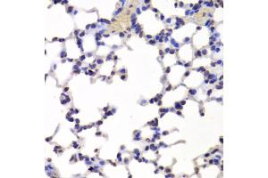 Immunohistochemistry of paraffin-embedded mouse lung using INTS6 Antibody (ABIN5973991) at dilution of 1/100 (40x lens). (INTS6 antibody)