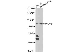 Western blot analysis of extracts of various cell lines, using ACSS2 antibody (ABIN6292756) at 1:1000 dilution.