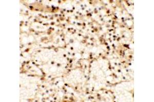 Immunohistochemical anyalysis of human spleen tissue with CLEC7A polyclonal antibody  at 5 ug/mL. (CLEC7A antibody  (Internal Region))
