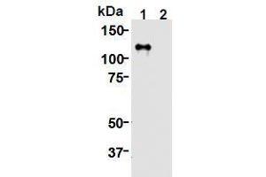 Western Blotting (WB) image for anti-Kinesin Family Member 11 (KIF11) (AA 1-1056), (N-Term) antibody (ABIN1449287)