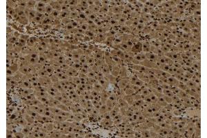 ABIN6272892 at 1/100 staining Mouse liver tissue by IHC-P.