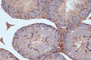 Immunohistochemistry of paraffin-embedded mouse testis using STK3/MST2 Rabbit mAb (ABIN7270223) at dilution of 1:100 (40x lens). (STK3 antibody)