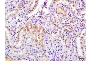 Formalin-fixed and paraffin embedded rat kidney labeled with Rabbit Anti Phospho-Bcl-2(Ser70) Polyclonal Antibody, Unconjugated (ABIN683428) at 1:200 followed by conjugation to the secondary antibody and DAB staining (Bcl-2 antibody  (pSer70))