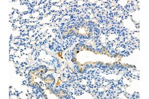 ABIN6265492 and ABIN6277002 at 1/100 staining Mouse kidney tissue by IHC-P.