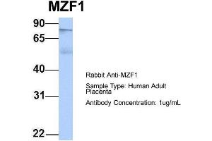 Host: Rabbit Target Name: MZF1 Sample Type: Human Adult Placenta Antibody Dilution: 1. (MZF1 antibody  (N-Term))