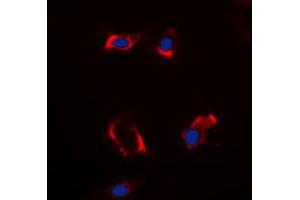 Immunofluorescent analysis of Cytochrome P450 2S1 staining in HepG2 cells. (CYP2S1 antibody  (Center))