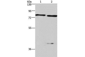 Western Blot analysis of Mouse brain and kindey tissue using COL4A3BP Polyclonal Antibody at dilution of 1:300