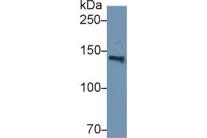 Detection of ORP150 in Human Serum using Polyclonal Antibody to 150 kDa Oxygen Regulated Protein (ORP150) (150 kDa Oxygen Regulated Protein (AA 695-994) antibody)
