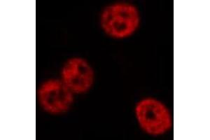 ABIN6277977 staining CoLo cells by IF/ICC. (FYB antibody)