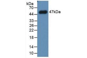 Detection of Recombinant PAI1, Human using Monoclonal Antibody to Plasminogen Activator Inhibitor 1 (PAI1) (PAI1 antibody)
