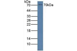 Detection of RYK in Human Jurkat Cells using Polyclonal Antibody to Related To Receptor Tyrosine Kinase (RYK) (RYK antibody  (AA 287-533))