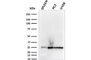 Western Blot Analysis of human spleen, PC3 and liver lysates using C1QA Mouse Monoclonal Antibody (C1QA/2783). (C1QA antibody  (AA 104-237))