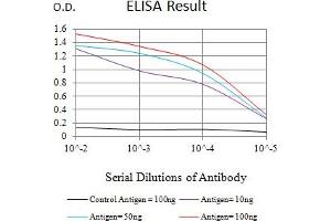 Black line: Control Antigen (100 ng),Purple line: Antigen (10 ng), Blue line: Antigen (50 ng), Red line:Antigen (100 ng) (IL18R1 antibody  (AA 22-185))