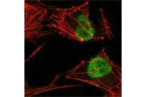 Confocal immunofluorescence analysis of Hela cells using MSH2 antibody (green), showing nuclear localization. (MSH2 antibody)