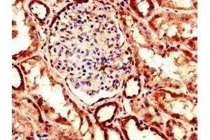 Immunohistochemistry of paraffin-embedded human kidney tissue using ABIN7151457 at dilution of 1:100 (EHD2 antibody  (AA 401-543))