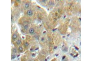 Used in DAB staining on fromalin fixed paraffin-embedded Liver tissue (FUCA1 antibody  (AA 170-420))