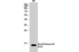 Western Blotting (WB) image for anti-Histone H4 (acLys16) antibody (ABIN6285459) (Histone H4 antibody  (acLys16))