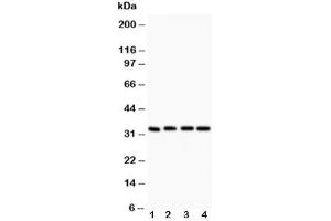 Western blot testing of Caspase-3 antibody (0.