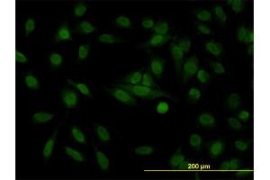 Immunofluorescence of monoclonal antibody to STAG1 on HeLa cell. (Stromal Antigen 1 antibody  (AA 1112-1221))