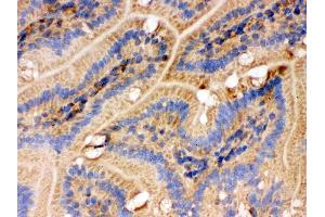 Immunohistochemistry (IHC) image for anti-Isocitrate Dehydrogenase 2 (NADP+), Mitochondrial (IDH2) (AA 413-447), (C-Term) antibody (ABIN3043856)