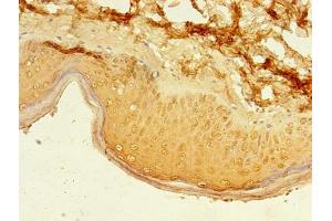 Immunohistochemistry of paraffin-embedded human skin tissue using ABIN7162495 at dilution of 1:100 (Paired Box 3 antibody  (AA 90-184))