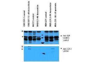 Western blot using  Affinity Purified anti-E2F-1 pS364 antibody shows detection of a band at ~47 kDa corresponding to phosphorylated E2F-1 in induced cell lysates. (E2F1 antibody  (pSer364))