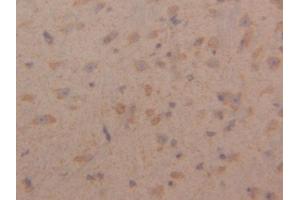 DAB staining on IHC-P; Samples: Mouse Cerebrum Tissue (Peroxiredoxin 3 antibody  (AA 64-257))