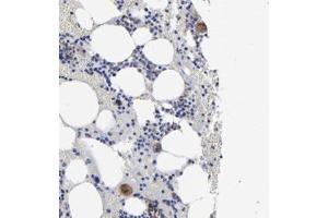 Immunohistochemical staining of human bone marrow with EMILIN1 polyclonal antibody  shows moderate cytoplasmic positivity in megakaryocytes.
