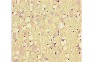 Immunohistochemistry (IHC) image for anti-MutL Homolog 1 (MLH1) (AA 350-519) antibody (ABIN7150201)