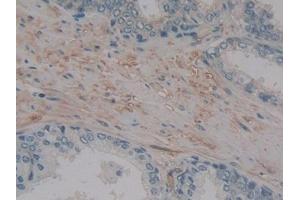 Detection of MMP14 in Human Prostate Tissue using Polyclonal Antibody to Matrix Metalloproteinase 14 (MMP14)