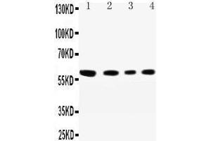 Western Blotting (WB) image for anti-Cell Adhesion Molecule 1 (CADM1) (AA 73-92), (N-Term) antibody (ABIN3042543) (CADM1 antibody  (N-Term))